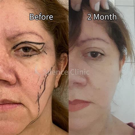 Gallery – Stem Cell Clinic