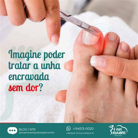 O Que Fazer Com Unha Encravada - Unha encravada - Trate sem dor! - Pé Demais Podologia