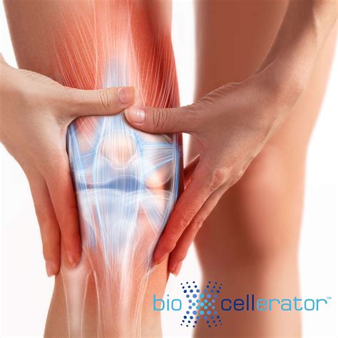 Can You Treat a Meniscus Tear Without Surgery? - BioXcellerator
