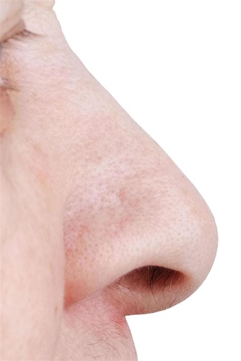 Large human nose 3512632 Stock Photo at Vecteezy