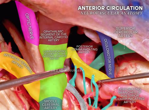 Dr.Z - Anterior circulation supplies over 80% of the brain’s blood note
