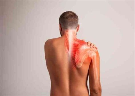 Snapping Scapula Syndrome | Scapulothoracic Bursitis | Orthopedic ...