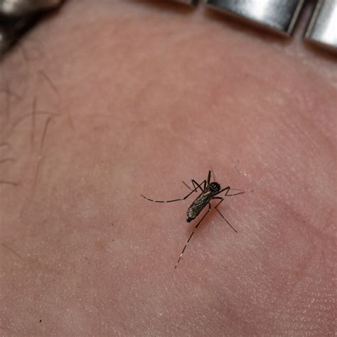Inflamed Mosquito Bite Ask A Allergy Specialist Online For Mosquito