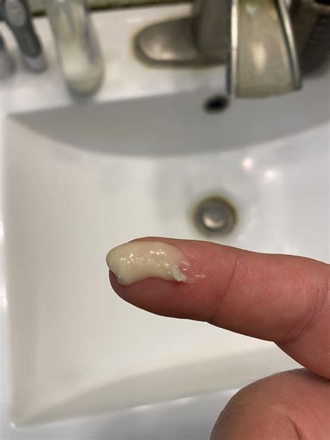 Cyst like bump on vagina - doncartoon