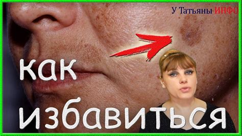 А ты знаешь? Маска от пигментных пятен в домашних условиях! - YouTube