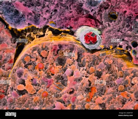 pituitary gland coloured scanning electron micro graph sem