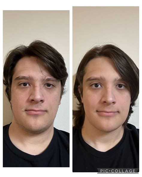 (26 MTF) How’s My Progress So Far? 6 Months on HRT + 4 Sessions of ...
