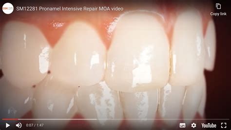 Pronamel Intensive Enamel Repair Before And After | informacionpublica ...