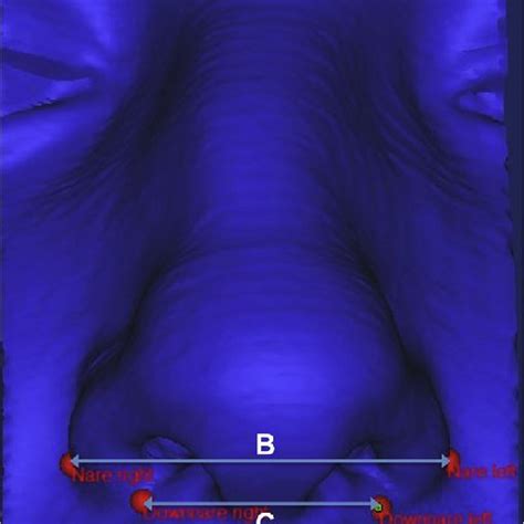 Skeletal nasal parameters. The piriform aperture width (PAW) is the ...