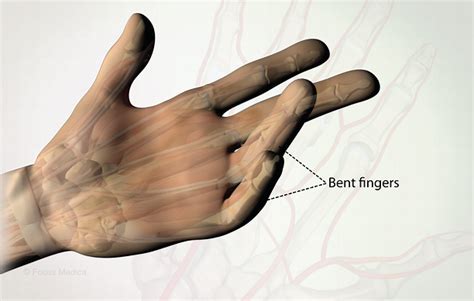 health condition symptoms  treatment