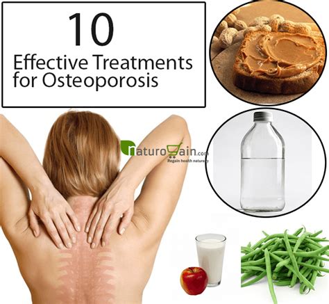 Natural Osteoporosis Treatment - 10 Effective Treatments for Osteoporosis