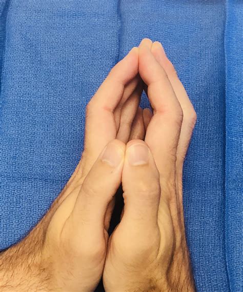 DIABETES MELLITUS | Hand Surgery Resource