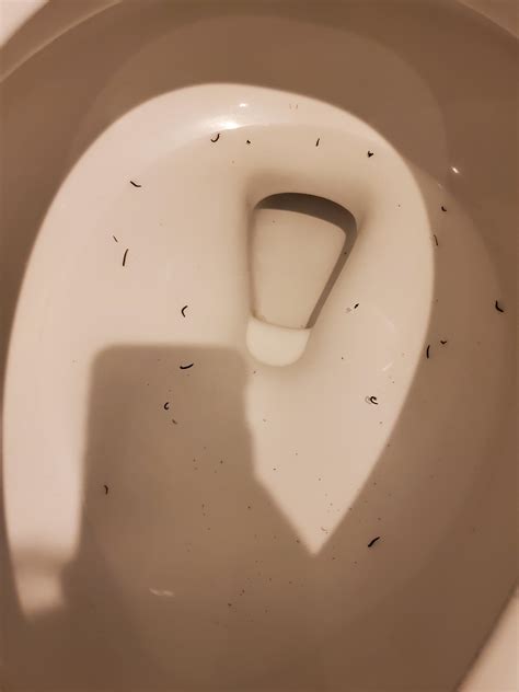Tapeworm In Toilet Pinworm Infection Symptoms & Causes Mayo Clinic