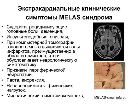 Митохондриальные болезни - презентация онлайн