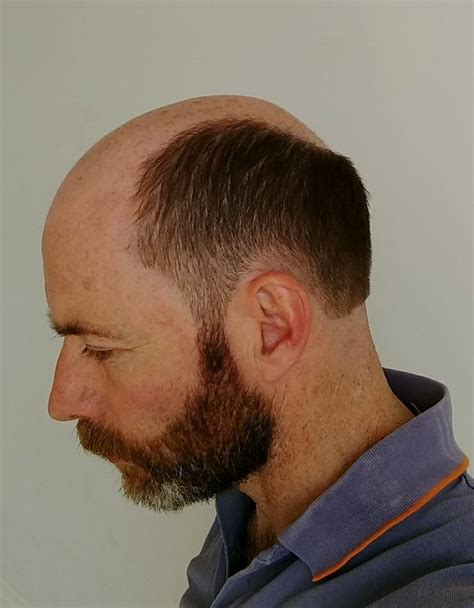 Pin by Alfred Scholz on special effect | Bald men with beards, Male ...