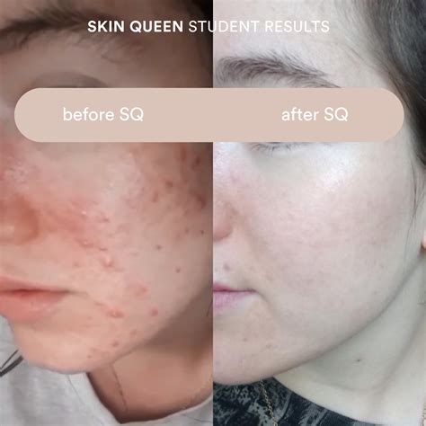 Skin Queen Course About – olena beley.