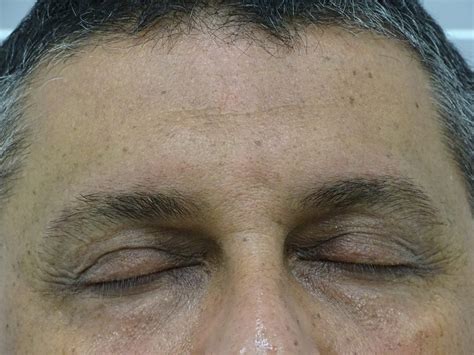 10 Minute Facelift Lessen The Signs Of Ageing The