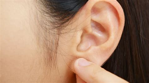 pimple   earlobe treatments   prevention