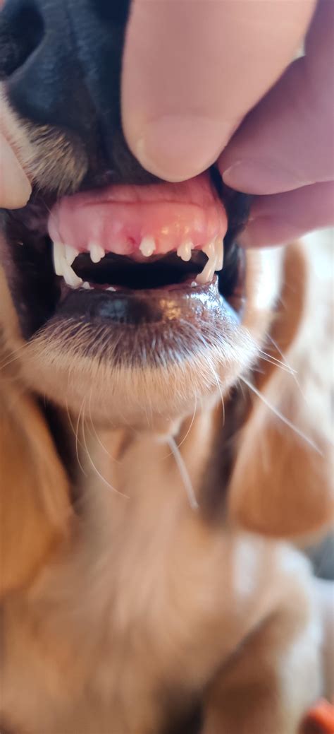 She lost a tooth! Do her teeth appear to be coming in normal? I think