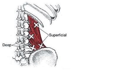 trigger points    pain brandon cope