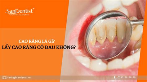 cao rang la gi lay cao rang  dau khong