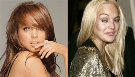 Phun Forum Celebrity Extra: The Truth About Celebrity Plastic Surgery! - 1bsfj5t