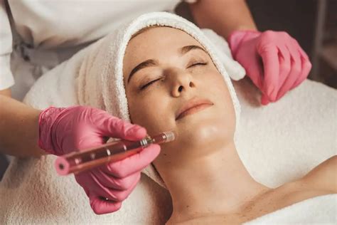 Skin Radiance Unveiled: The Truth About Microneedling