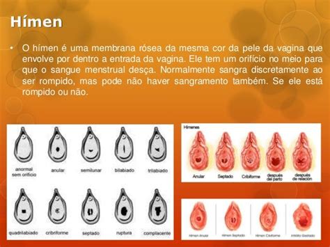Onde Fica O Hímen Feminino