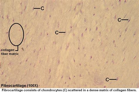 Fibrocartilage Histology Labeled