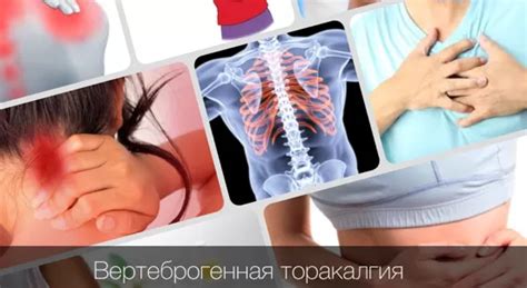 Вертеброгенная торакалгия: причины, симптомы и лечение