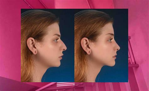 Fundraiser for Kim pamela Fox by Evelyn Fox : Evelyn's Facial