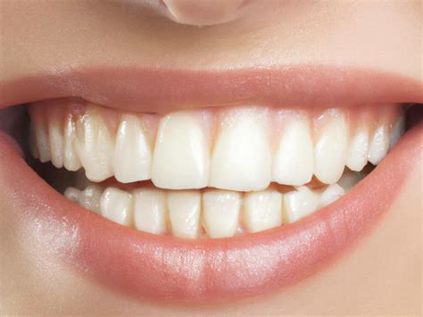 Crooked Teeth: Causes, Impact, And Treatment - My Smile Orthodontist