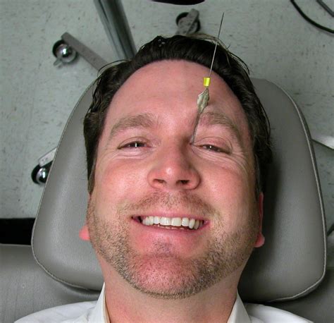 tear duct surgery gallery dallas ophthalmology surgeons texas