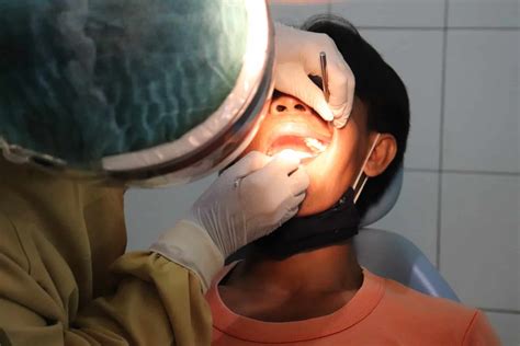 how much to get a cavity filled