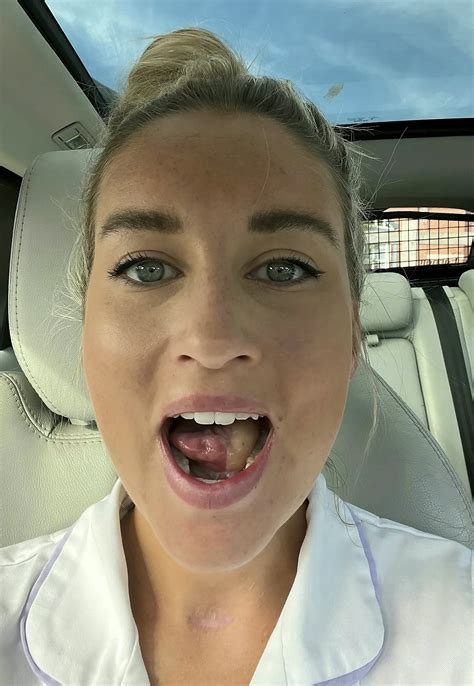 Woman told mouth ulcers were caused by wisdom teeth…