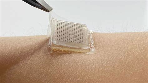 New Ultrasound Device Is Tiny, Sticks To Your Skin, And Produces Images ...