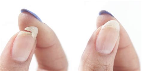 How to Get Rid of Chipped Nails