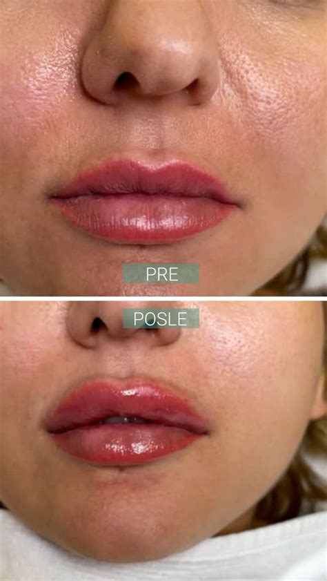 Dr Jelena Glavinić (@dr.jelena.glavinic.clinic) • Instagram photos and