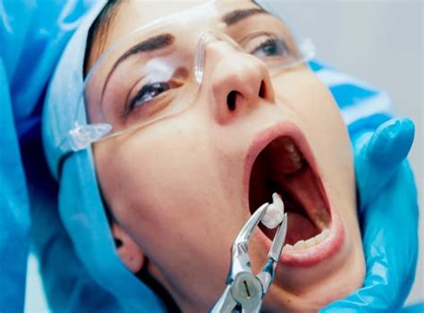 Tooth Extraction: What You Need To Know About It And Aftercare - Care ...