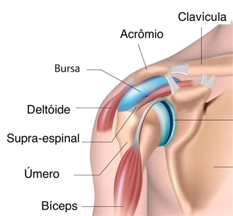 O Que E Bursite No Ombro - Tratamento para bursite no ombro - Dr Otávio Pécora