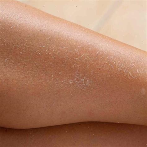 skin-classification Object Detection Dataset by Awan