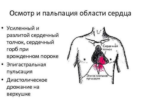 Синдромы при заболеваниях сердечно-сосудистой системы Синдром сердечной