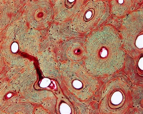 compact bone microscope