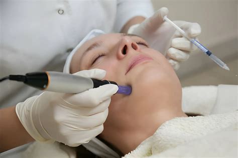 Microneedling: Benefits, Side Effects, Cost, Results