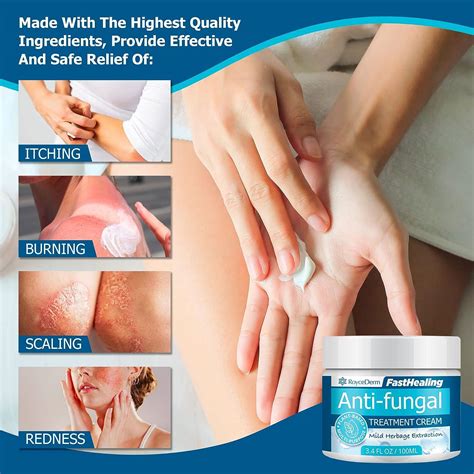 Roycederm Antifungal Cream - Maximum Strength Treatment for Athletes