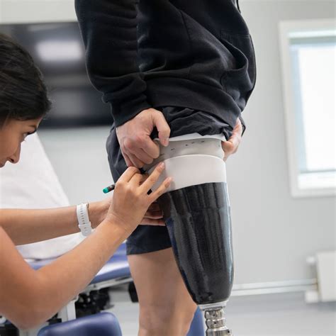 oessur legs complete prosthesis  patient outcome focus oessur uk