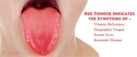 learn   tongue   general health