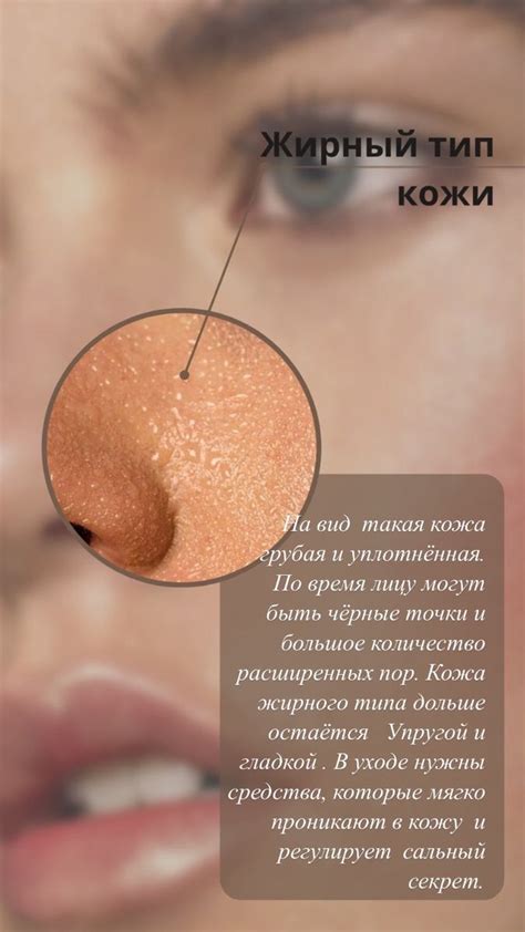Жирный тип кожи