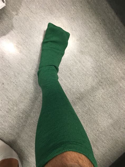62 best r/metoidioplasty images on Pholder | Over a year post op dr