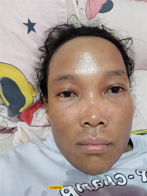 kulit menghitam hellosehat